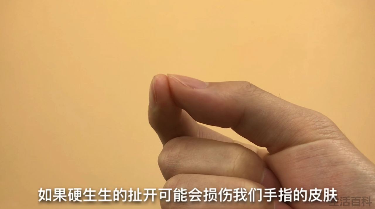 手被502粘住了怎么办
