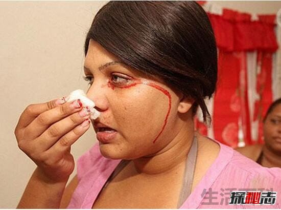 超恐怖泪血症