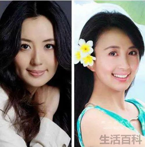宋林静个人资料简介