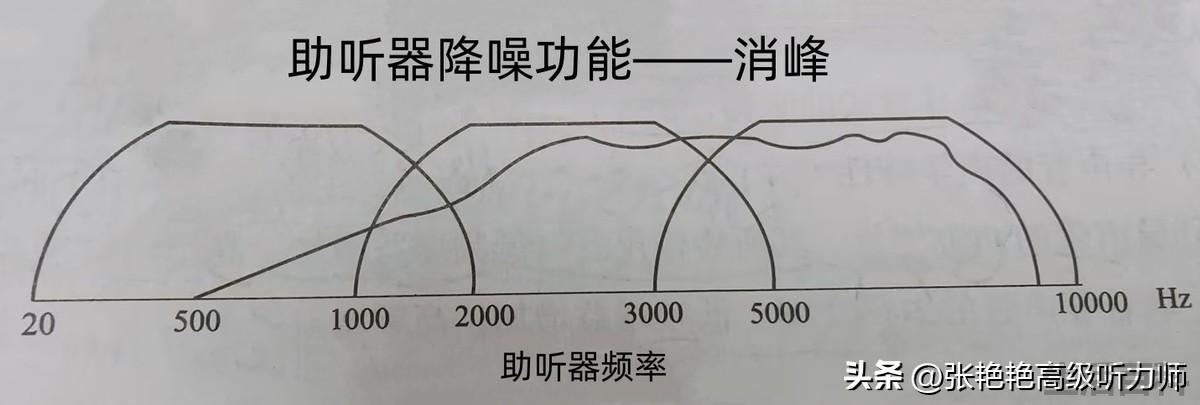 助听器的降噪功能有没有用