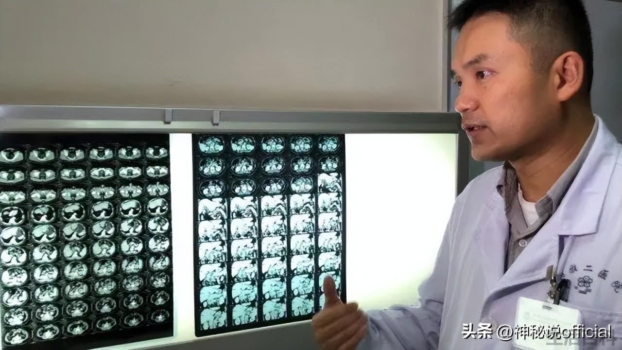湘雅刘翔峰事件始末