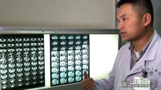 湘雅刘翔峰事件始末