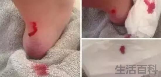 皮鞋磨脚怎么办