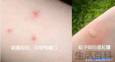 跳蚤只咬脚踝说明床上没有吗